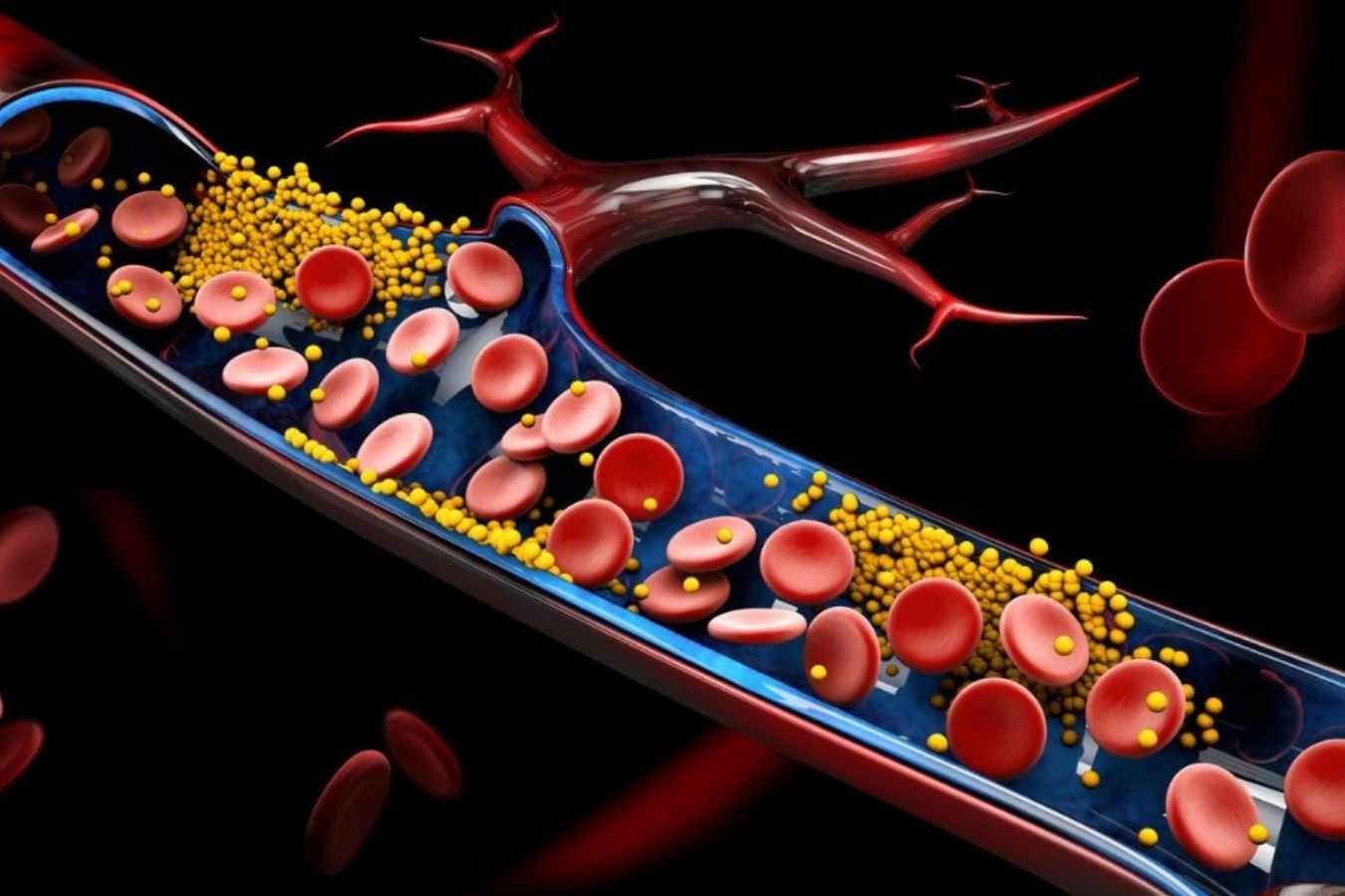 How to Build a 7 Day Diet to Lower Triglycerides?