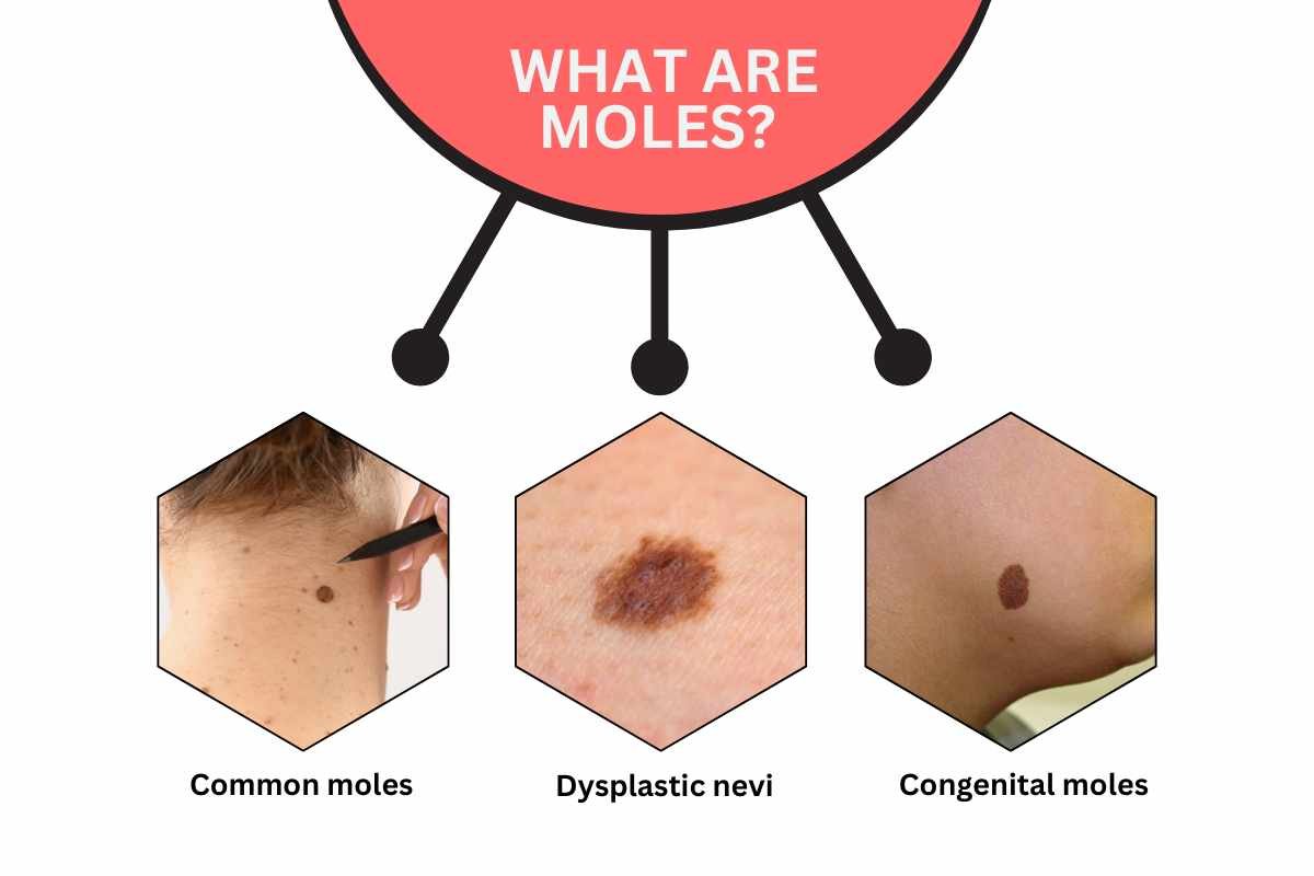 What are moles