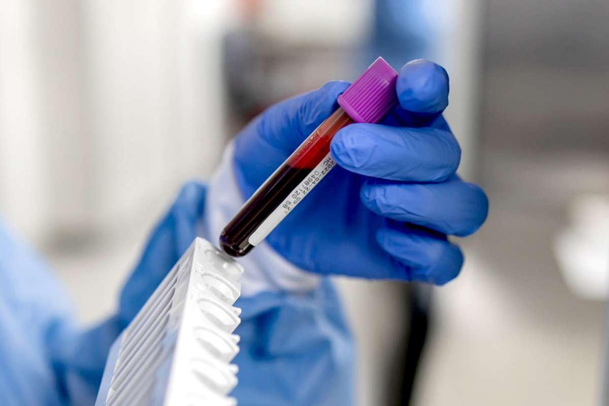 Why MCHC Blood Test is Important for Your Health? | The Lifesciences Magazine