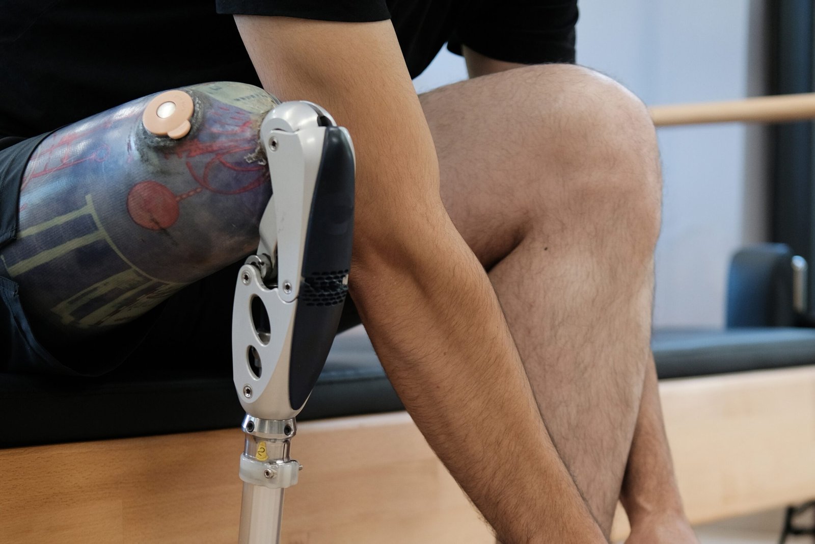 Orthopedic Implants: Types, Materials & Innovations | The Lifesciences Magazine
