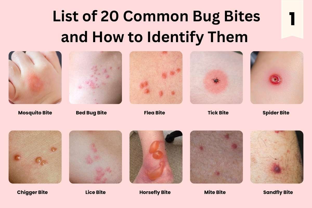 How to Identify Common Bug Bites That Could Harm Your Health? | The Lifesciences Magazine