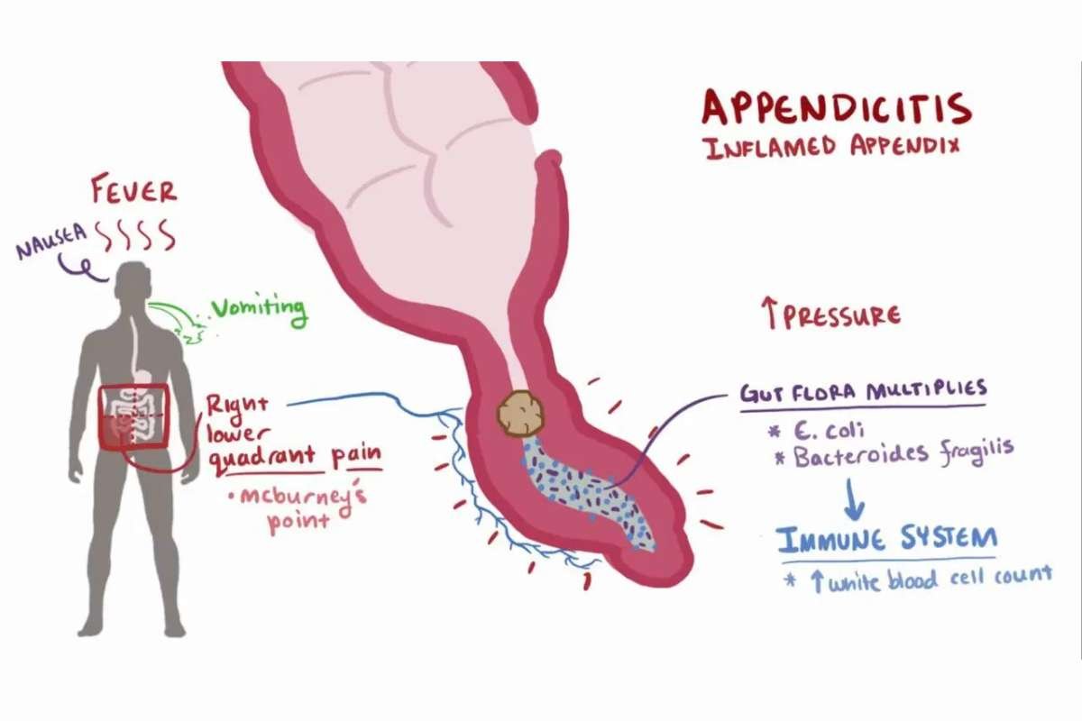 Abdominal Quadrants and Organs Help You Read Your Body Better | The Lifesciences Magazine