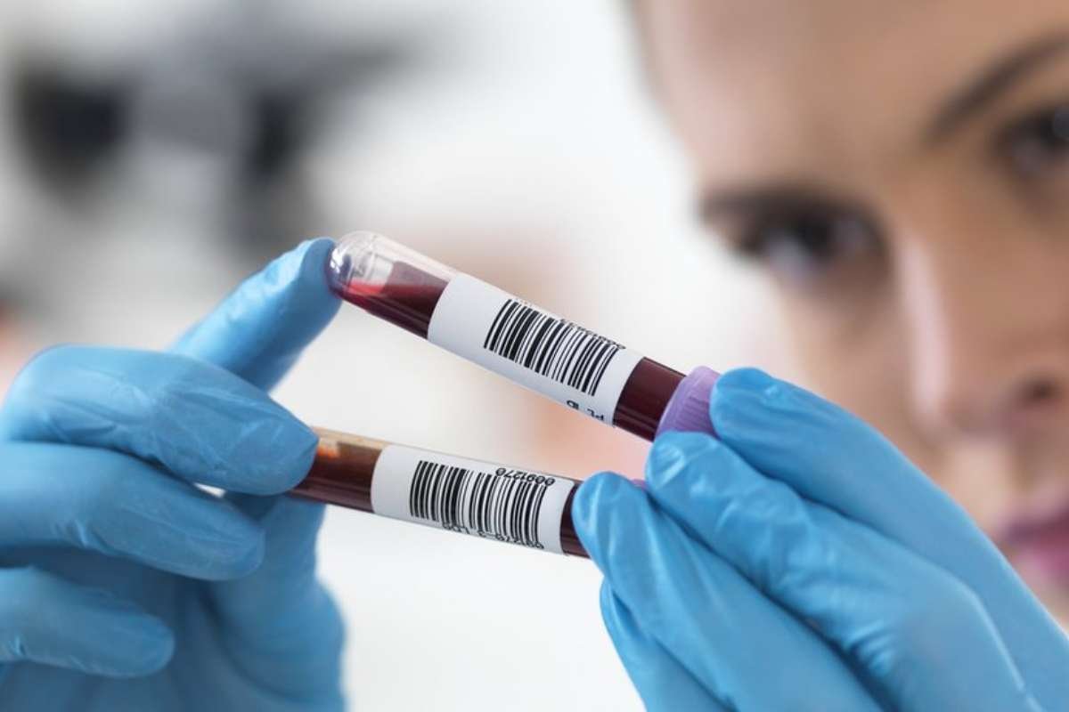 New organ aging blood test shows how fast your body is really aging | The Lifesciences Magazine