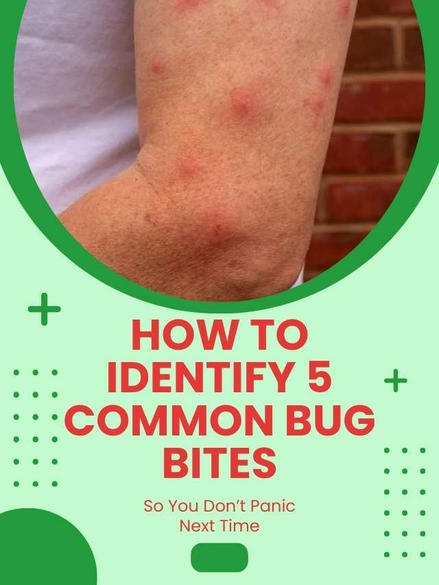 How to Identify Common Bug Bites That Could Harm Your Health?