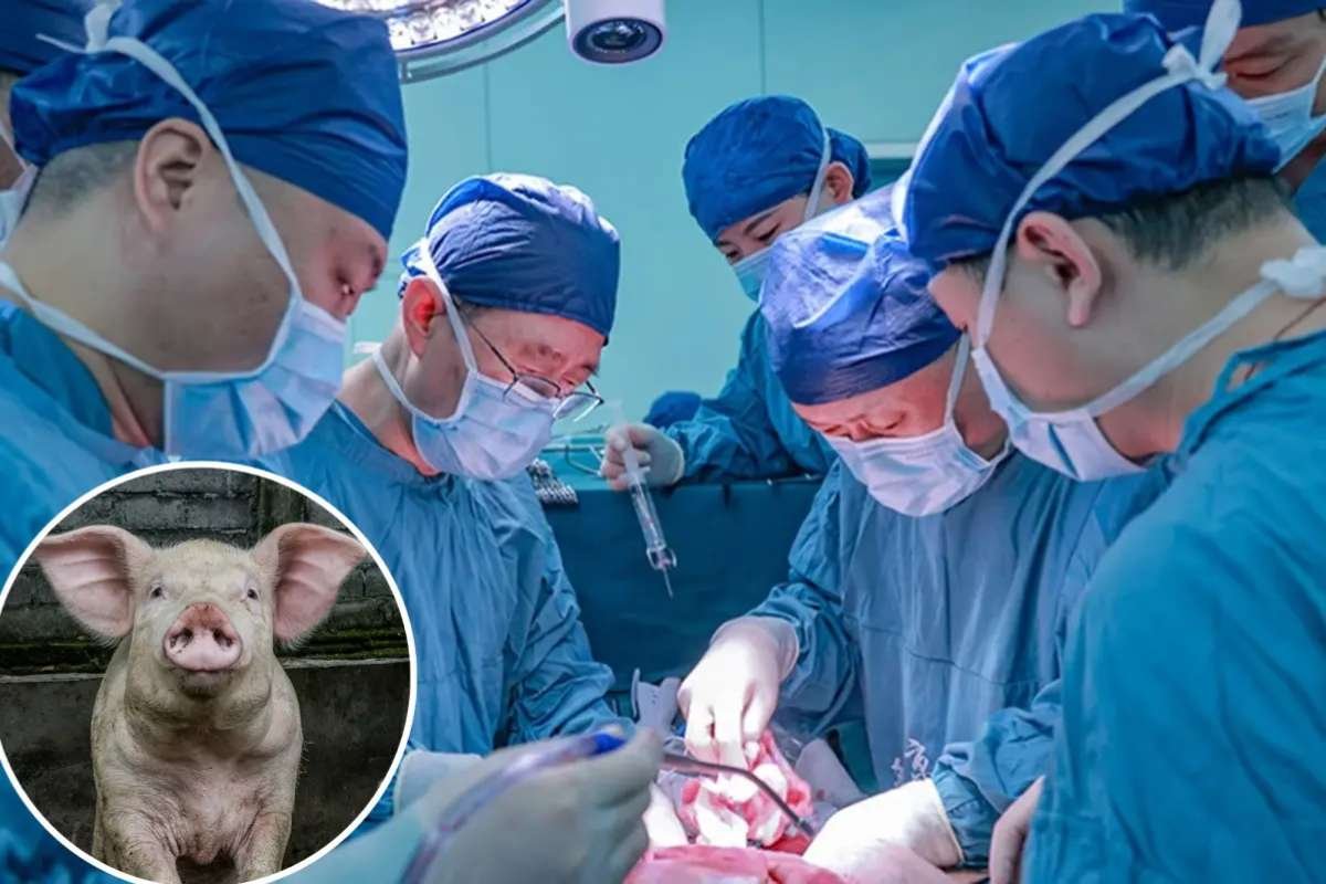 China Transplants First Gene-Edited Pig Lung Into Brain-Dead Patient | The Lifesciences Magazine