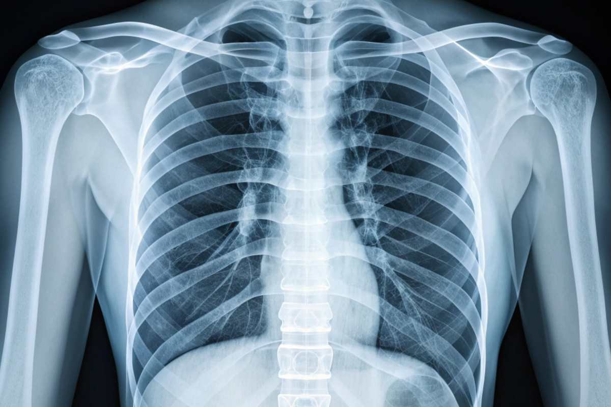 View more by ninjaDesign