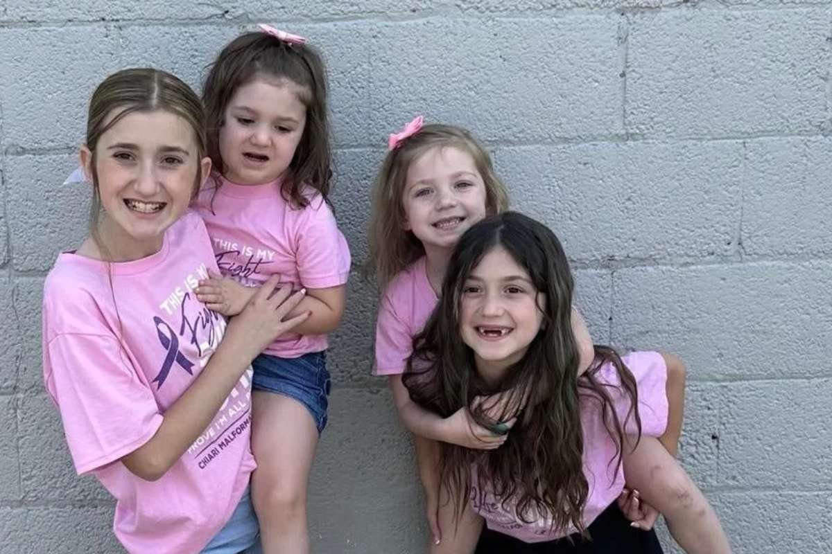 Chiari Malformation: Four Sisters in the U.S. Share the Same Rare Brain Disorder | The Lifesciences Magazine