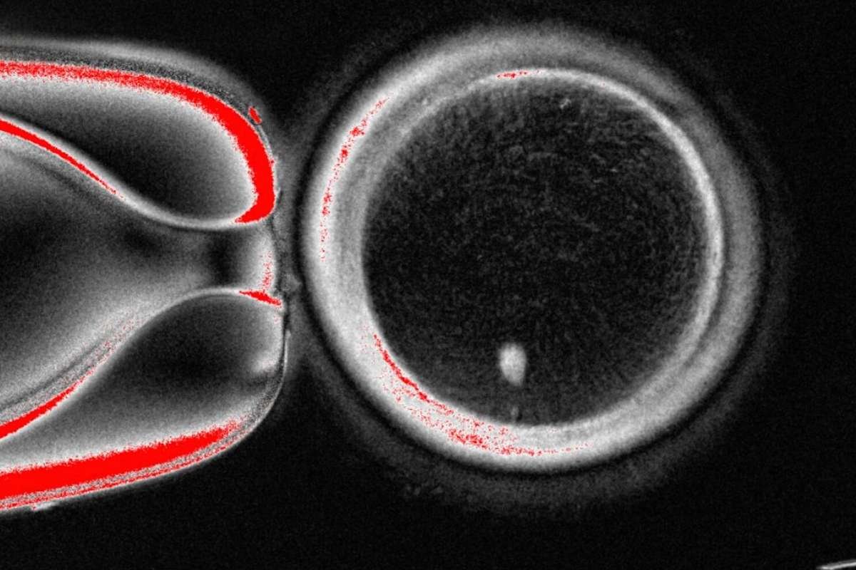 Human Eggs from Skin Cells: US Scientists’ New Technique Shows Promise | The Lifesciences Magazine