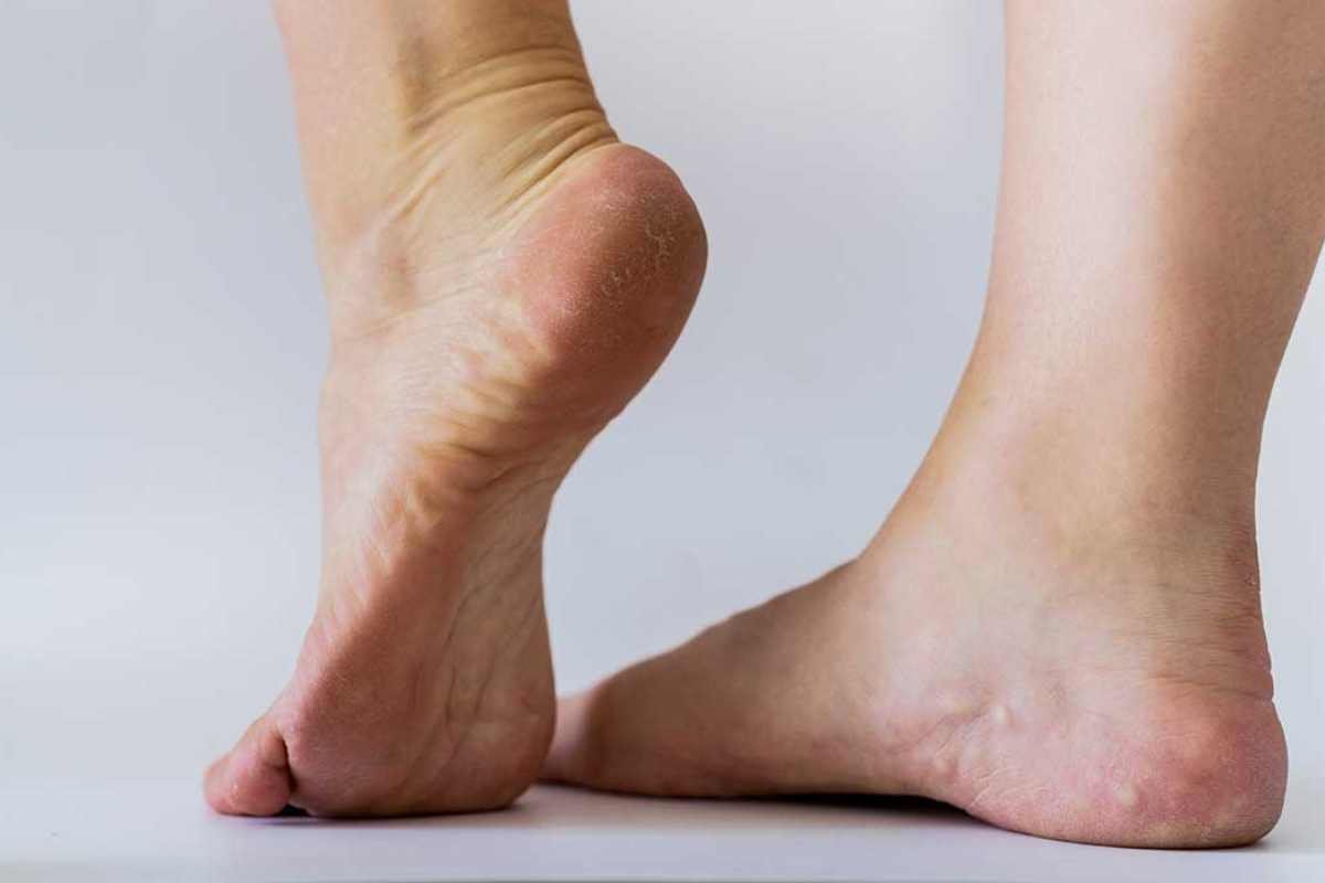 Common Foot Bumps and Lumps: Hidden Signs You Shouldn’t Ignore | The Lifesciences Magazine