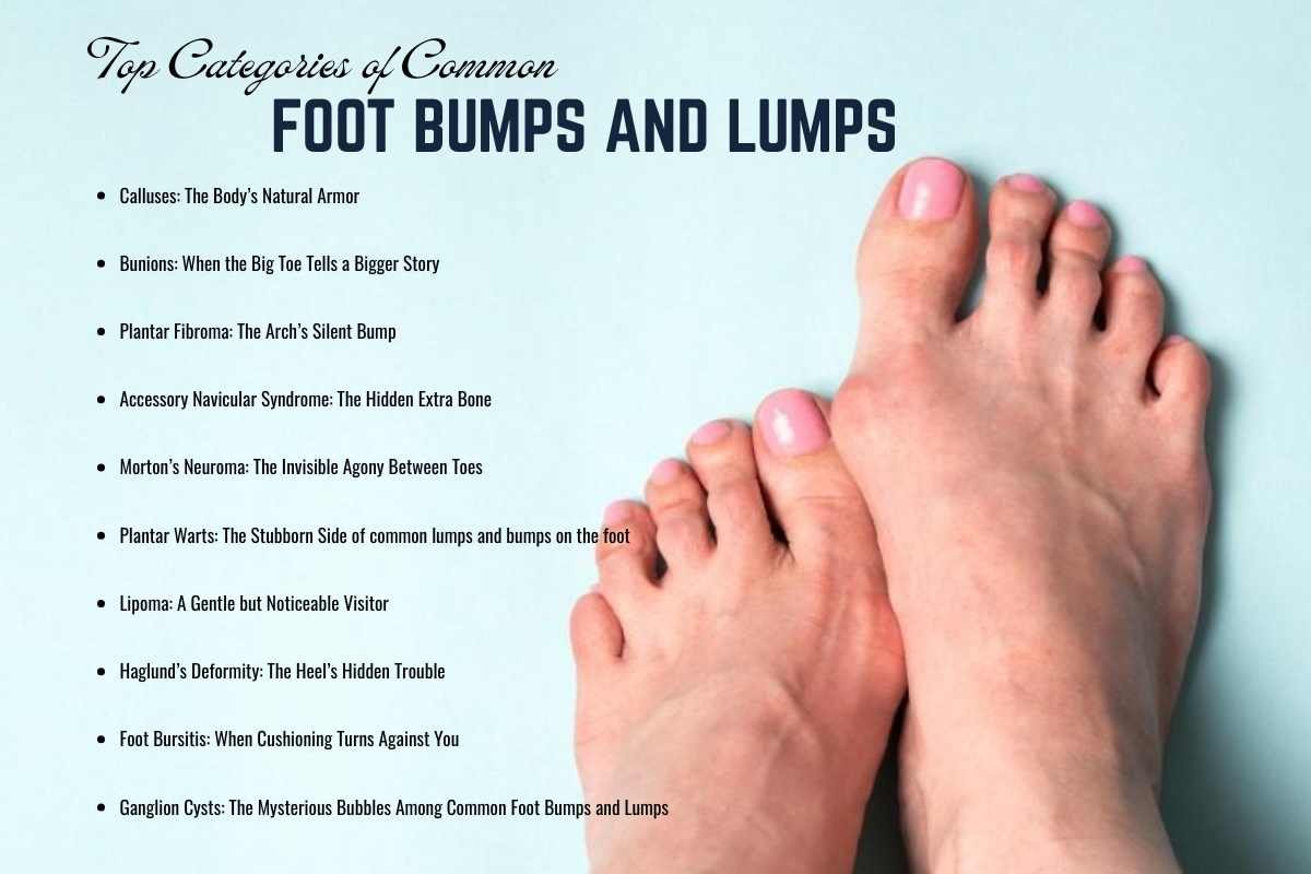 Common Foot Bumps and Lumps: Hidden Signs You Shouldn’t Ignore | The Lifesciences Magazine