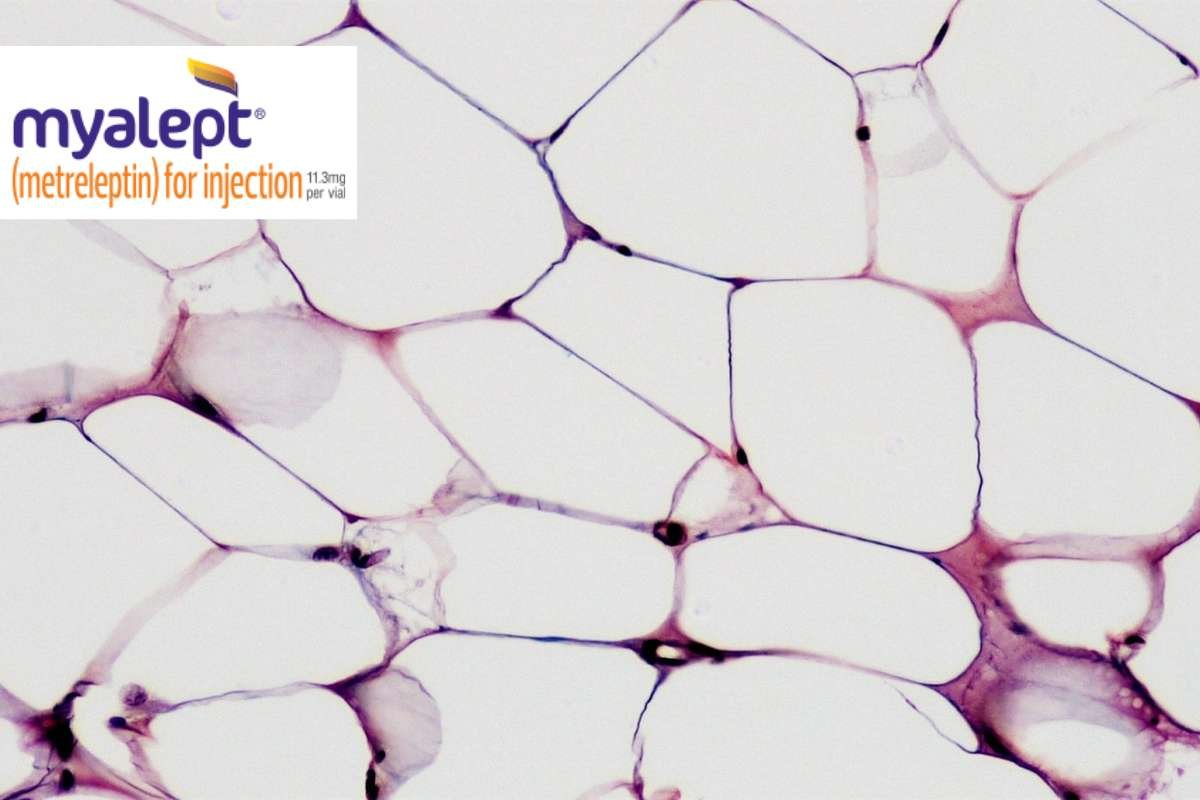 Most Expensive Drugs in the US: Shocking Price Tags Revealed | The Lifesciences Magazine