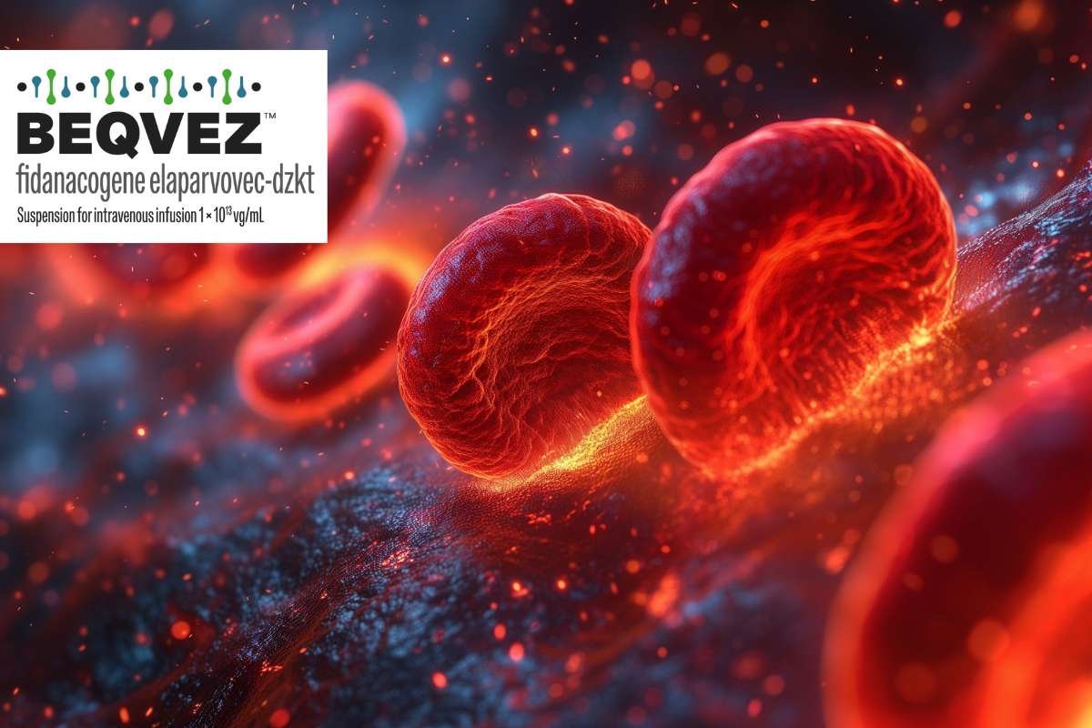 Most Expensive Drugs in the US: Shocking Price Tags Revealed | The Lifesciences Magazine