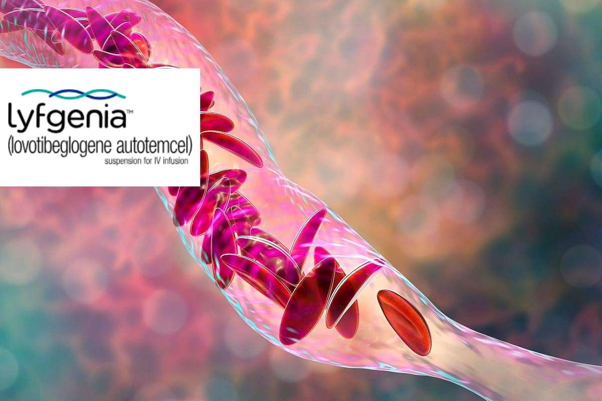 Most Expensive Drugs in the US: Shocking Price Tags Revealed | The Lifesciences Magazine