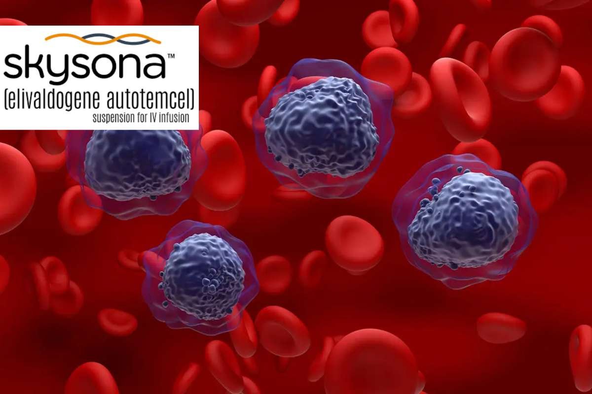 Most Expensive Drugs in the US: Shocking Price Tags Revealed | The Lifesciences Magazine