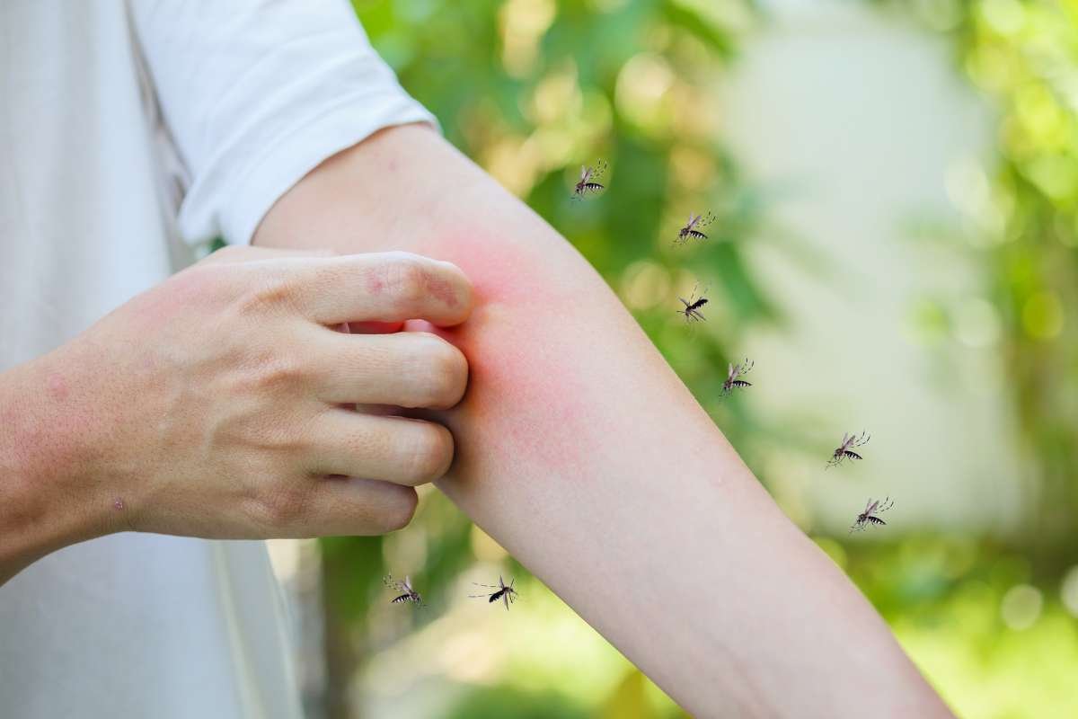 Why Mosquito Bites Itch: The Science behind the Irritation | The Lifesciences Magazine