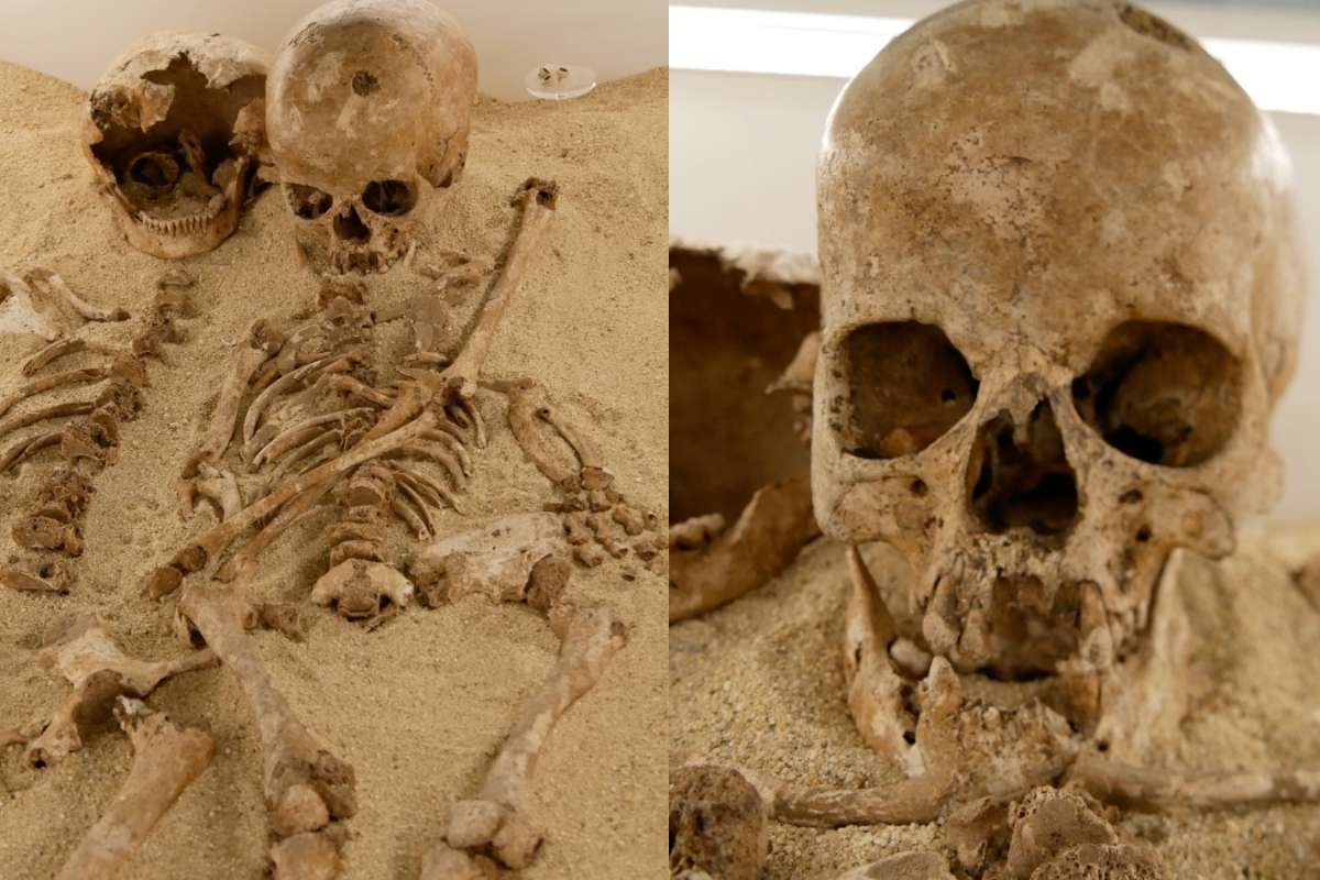 Stone Age Genetic Dwarfism Found In 12,000-Year-Old Teen | The Lifesciences Magazine