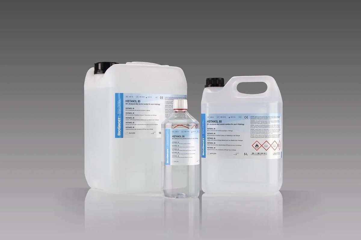 Perfume Poisoning: Hidden Dangers of Everyday Fragrance | The Lifesciences Magazine