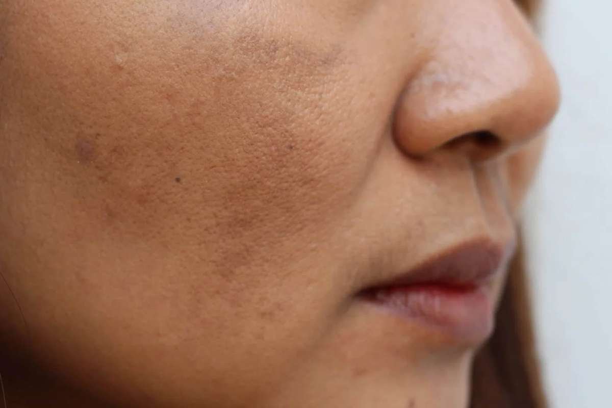 Copper Deficiency Symptoms You Should Never Ignore | The Lifesciences Magazine