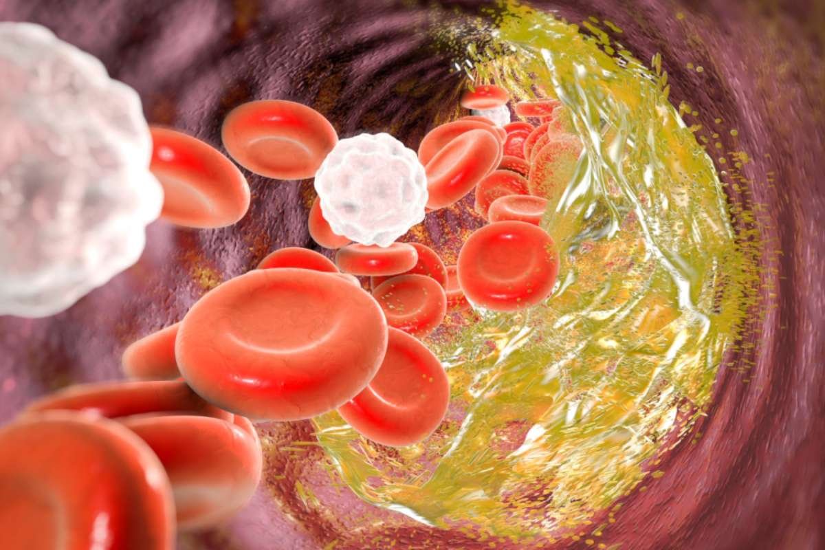 Gene-Editing Cholesterol Treatment: Clinical Trials Show Promise for One-Time Cure | The Lifesciences Magazine