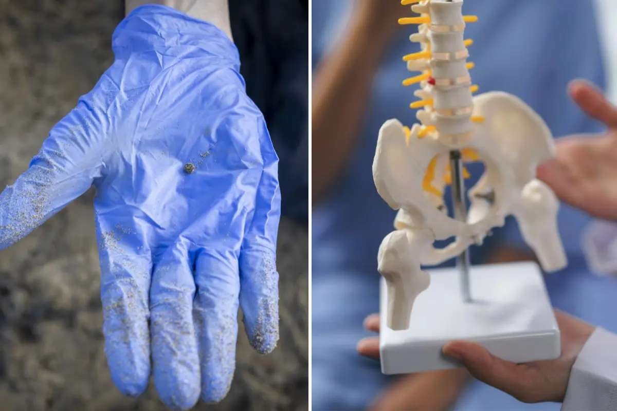 Microplastics in Prostate Cancer Tumors, NYU Study Finds | The Lifesciences Magazine