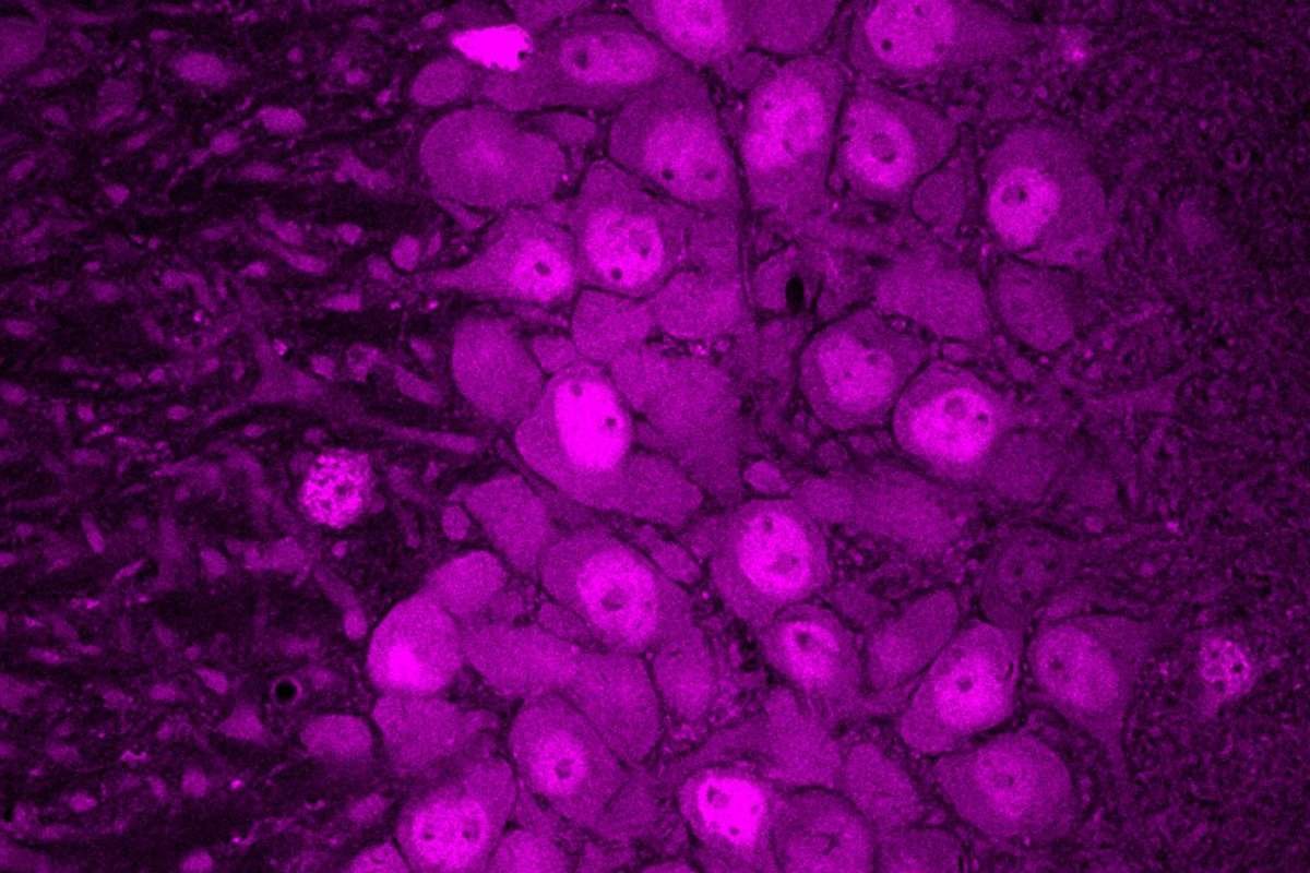 Scientists Map Isoform Translation in Mouse Brain Cells | The Lifesciences Magazine