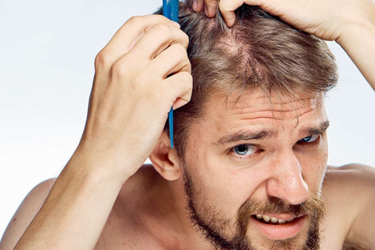 How Much Protein to Prevent Hair Loss Before Hairline Damage | The Lifesciences Magazine