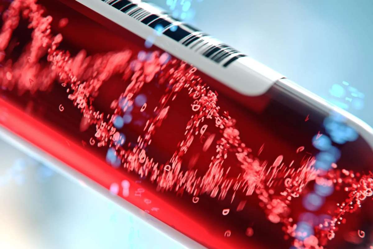 AI Blood Test for Early Liver Disease: New Study Highlights | The Lifesciences Magazine