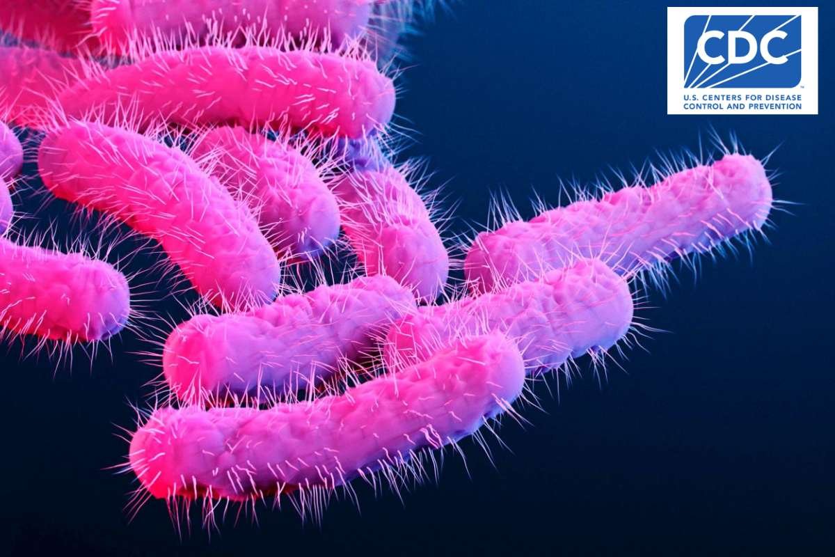 CDC Warns Drug-Resistant Shigella Infections Rising in US | The Lifesciences Magazine