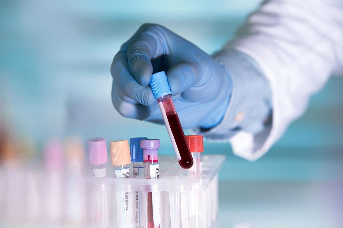 Multi-Cancer Blood Test Trial Setback but Shows Promise | The Lifesciences Magazine
