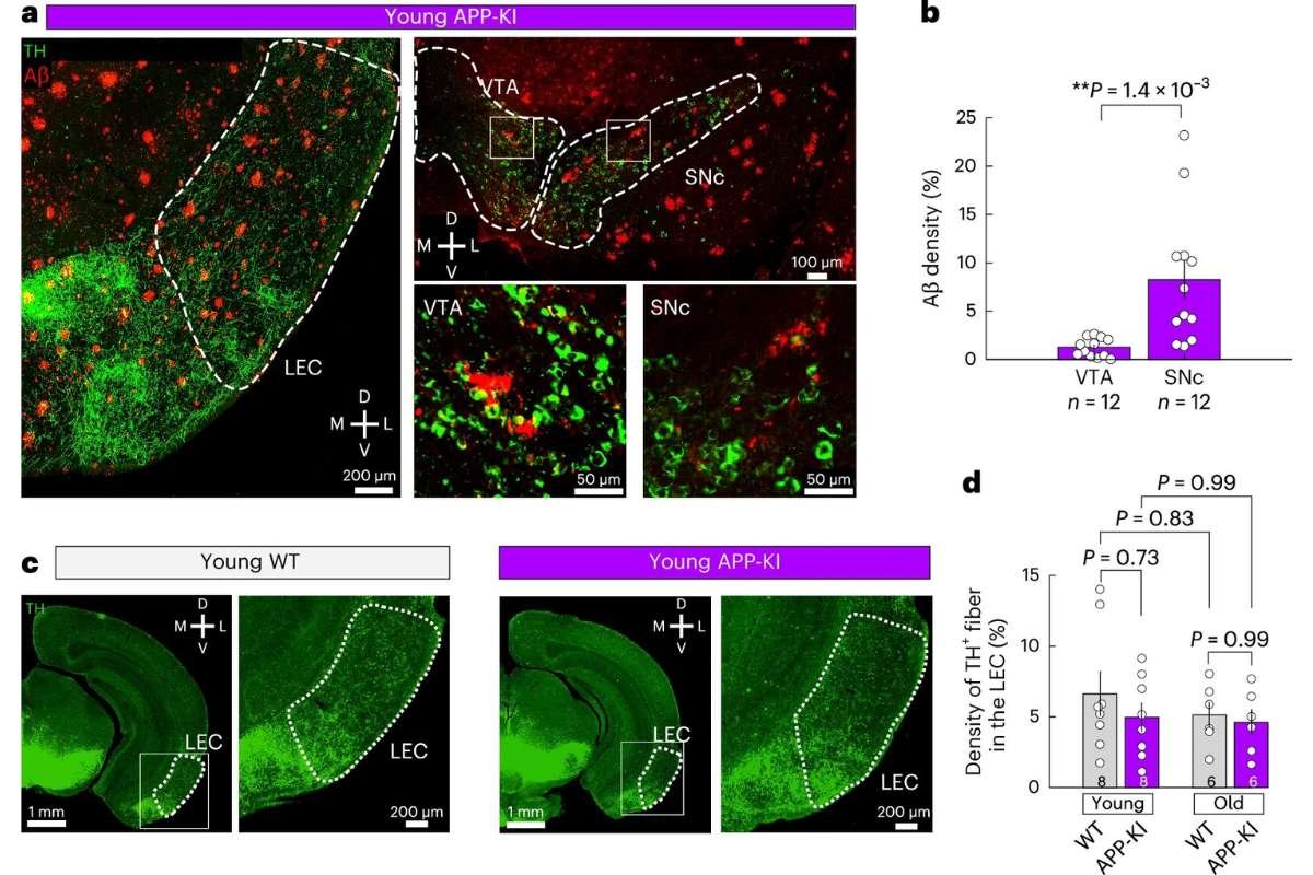 Dopamine Deficiency Linked to Alzheimer’s Memory Loss, Study | The Lifesciences Magazine
