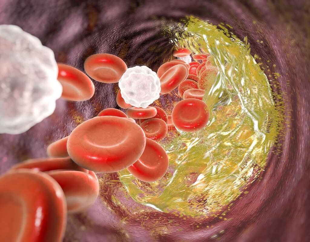 Types of Heart Disease: Symptoms, Causes & Prevention Guide | The Lifesciences Magazine