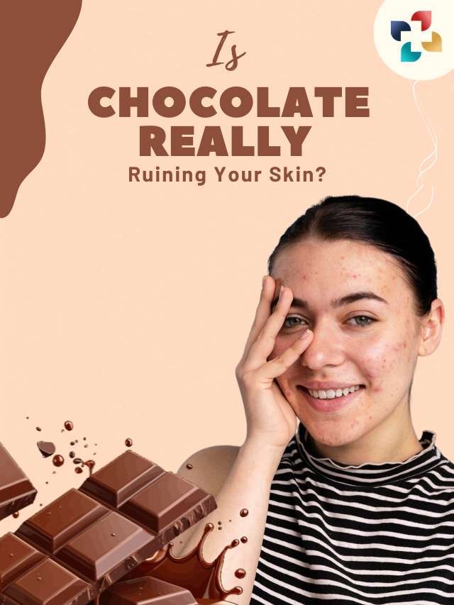 Does Chocolate Cause Acne? Myth or Truth Explained