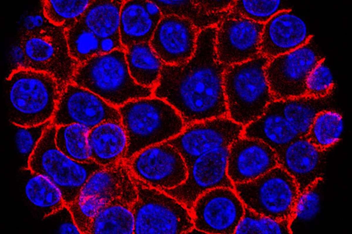 Pancreatic Cancer Treatment: Daraxonrasib Doubles Survival | The Lifesciences Magazine