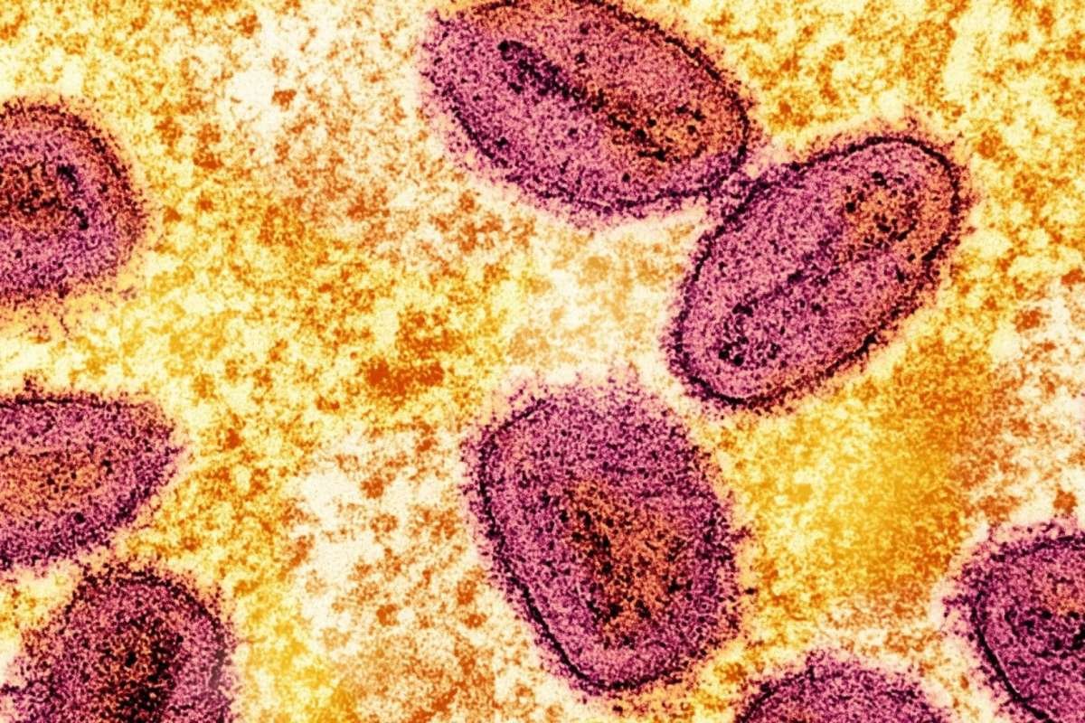 NIH Researchers Monkeypox Smuggling Case: Federal Charges | The Lifesciences Magazine