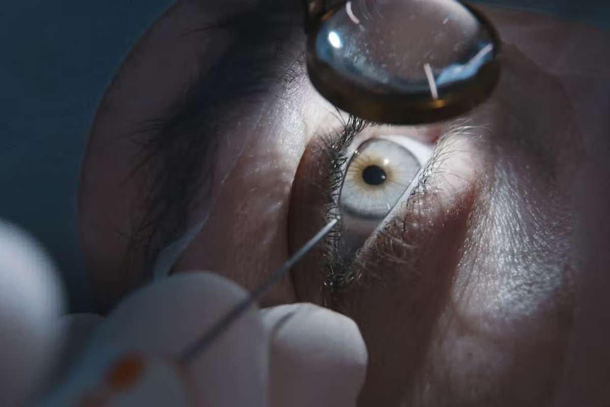 Refractive Surgery for Myopia vs Presbyopia: Key Differences Patients Should Know | The Lifescience Magazine