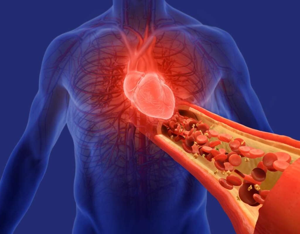 Understanding Hypertensive Heart Disease: Signs & Treatment | The Lifesciences Magazine