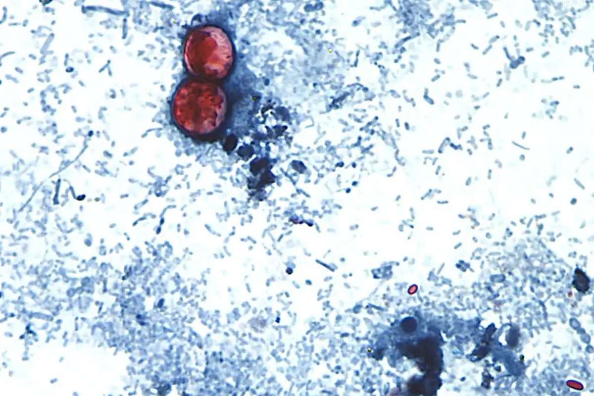 Alaska Cyclospora Cases Reach 5 as US Outbreak Continues | The Lifesciences Magazine