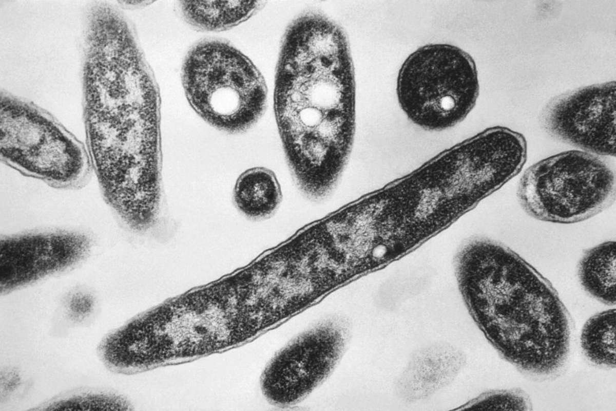 NYC Legionnaires Outbreak Slows as Cases Reach 60 | The Lifesciences Magazine