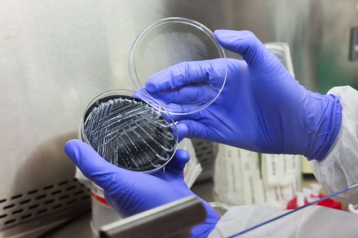 Upper East Side Legionnaires Outbreak Reaches 90 Cases | The Lifesciences Magazine