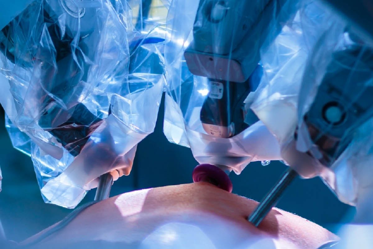 Robotic Surgery for Stomach Cancer Recovery Explained | The Lifesciences Magazine