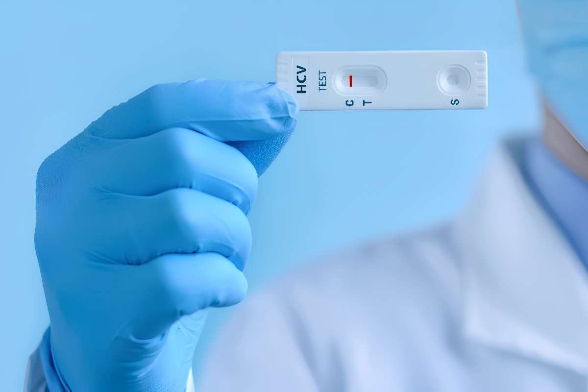 England Hepatitis C Elimination Advances With 100,000 Treated | The Lifesciences Magazine