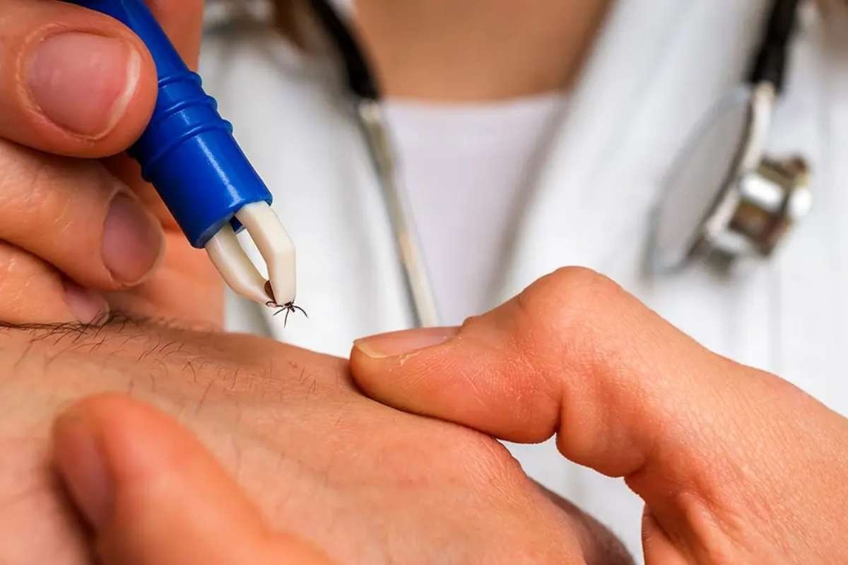 New York Bourbon Virus Case Confirmed After Tick Bite | The Lifesciences Magazine