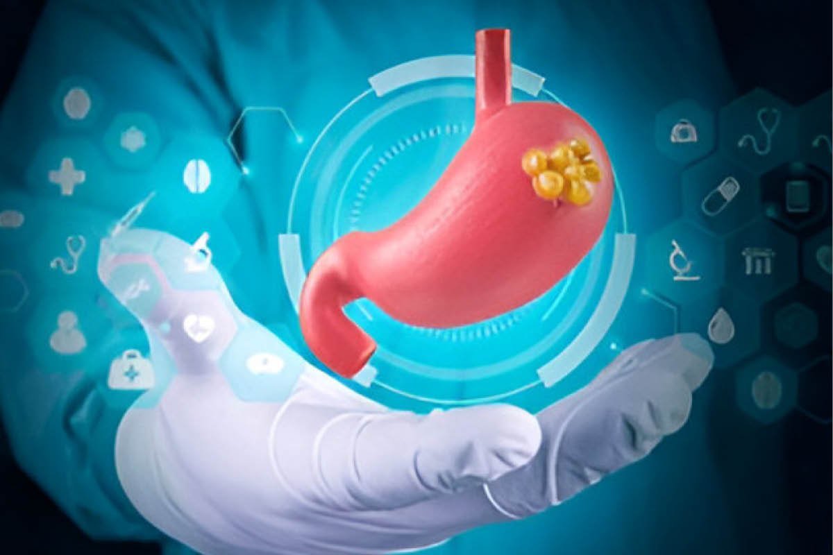 Robotic Surgery for Stomach Cancer Recovery Explained | The Lifesciences Magazine